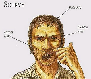 scurvy_Full